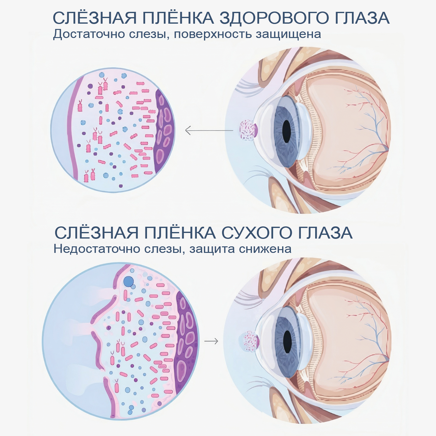 слёзная плёнка глаза