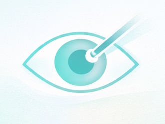 лазерная коррекция