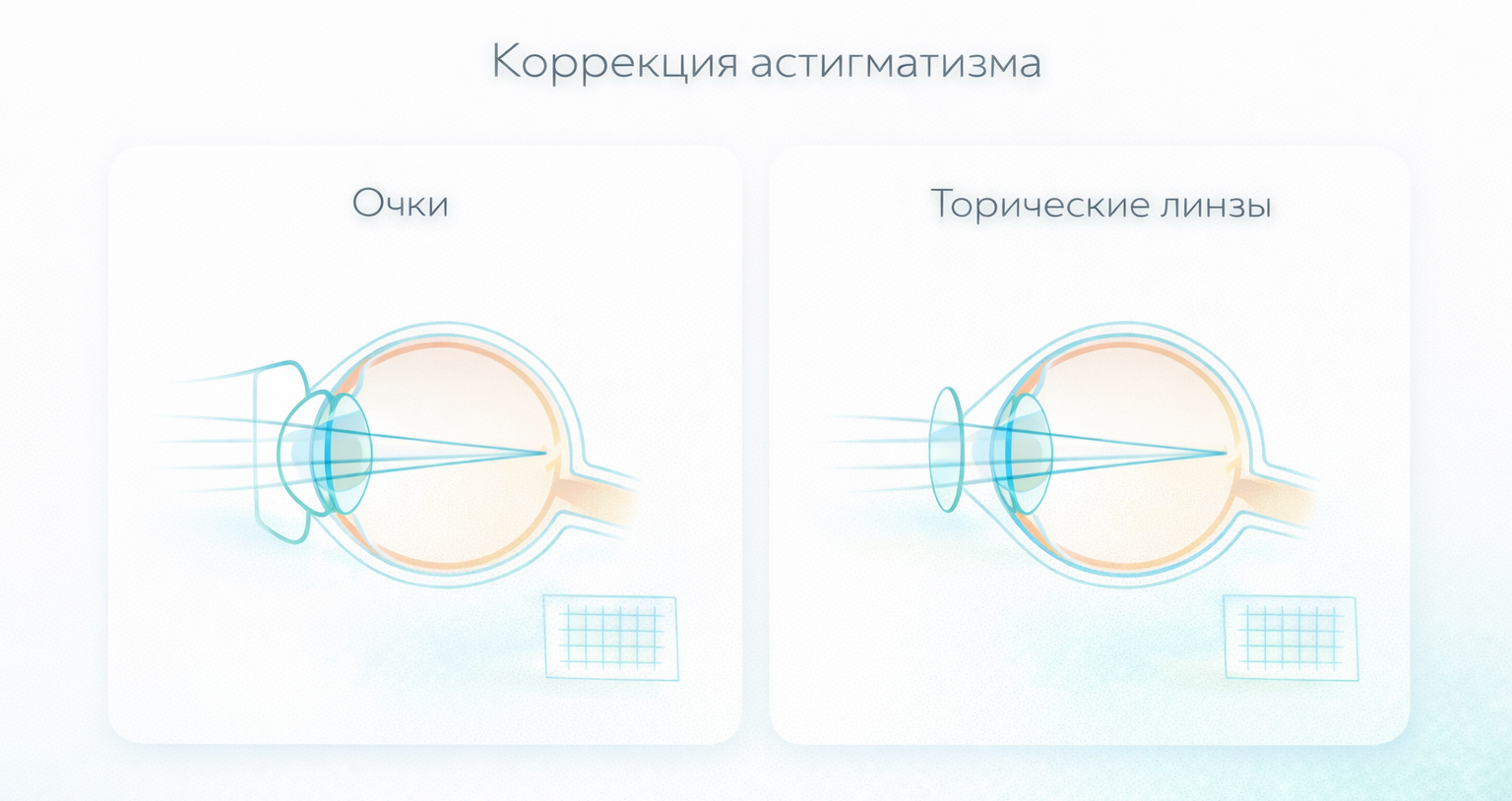 схема, показывающая, что очки и торические линзы выравнивают фокус по‑разному, но с одной целью