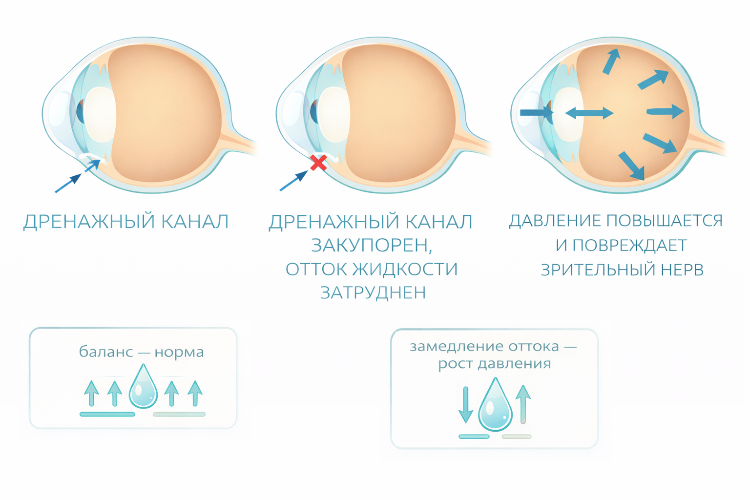 Регуляция внутриглазного давления